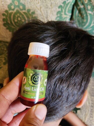 ANTI LICE OIL PACK OF 4 photo review
